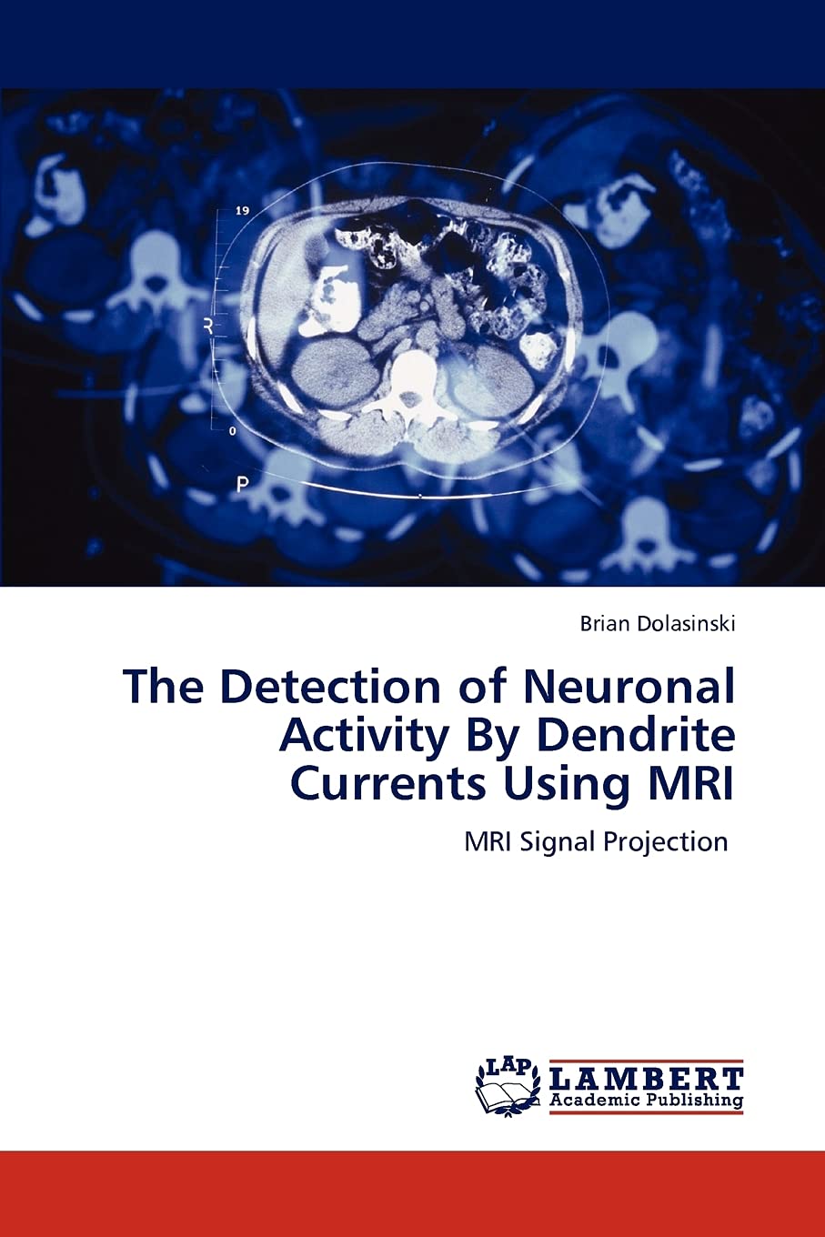 The Detection of Neuronal Activity By Dendrite Currents Using MRI: MRI Signal Projection,Used