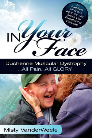 In Your Face Duchenne Muscular Dystrophy All Pain All Glory,Used