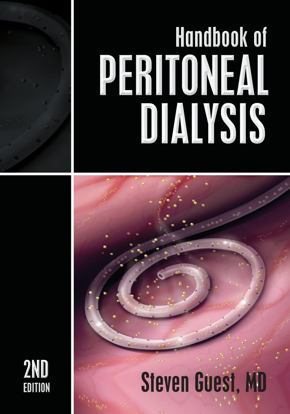Handbook Of Peritoneal Dialysis: Second Edition
