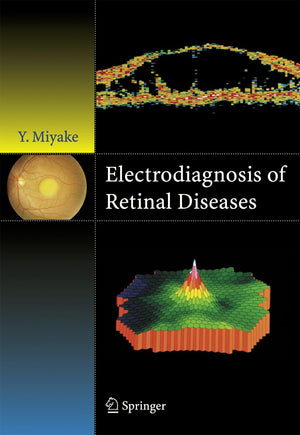 Electrodiagnosis of Retinal Disease,New