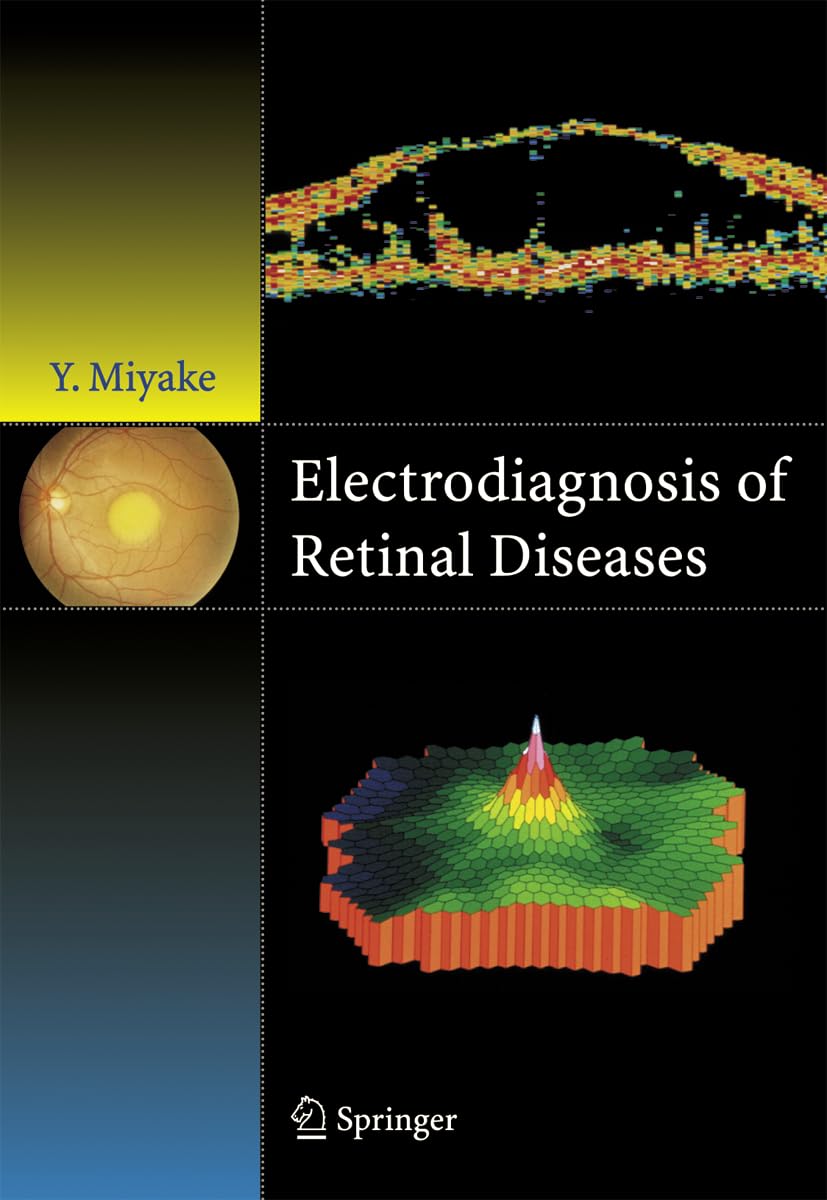 Electrodiagnosis of Retinal Disease,Used