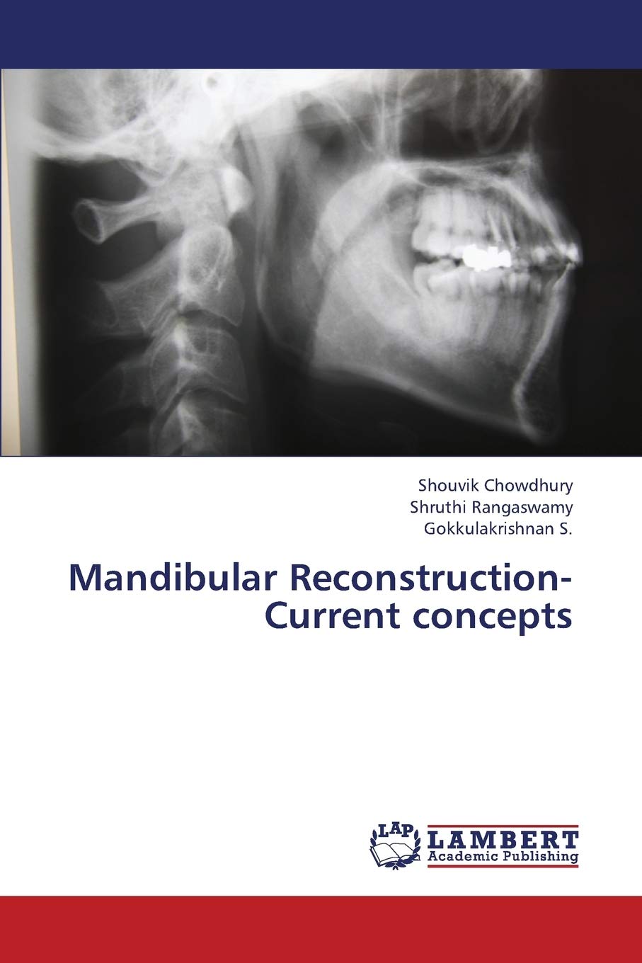 Mandibular Reconstruction Current concepts,Used