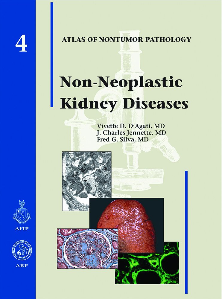 Nonneoplastic Kidney Diseases (Atlas Of Nontumor Pathology)