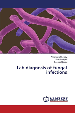 Lab diagnosis of fungal infections,Used
