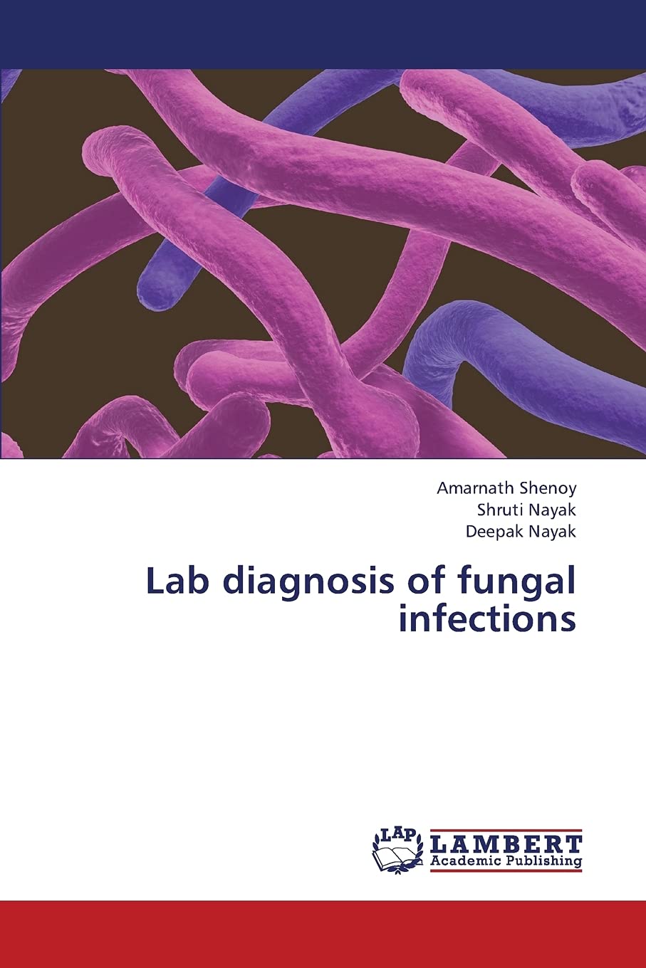 Lab diagnosis of fungal infections,Used