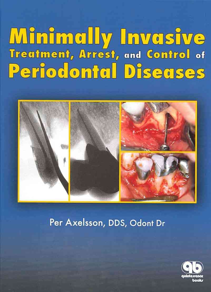 Minimally Invasive Treatment, Arrest, and Control of Periodontal Diseases (The Axelsson Series on Preventive Dentistry),New