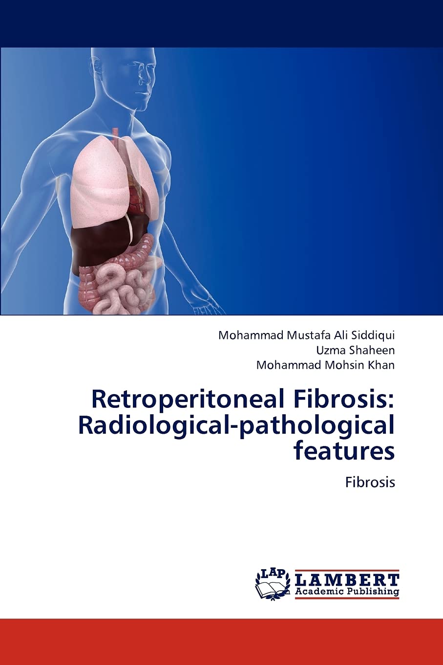 Retroperitoneal Fibrosis: Radiologicalpathological features: Fibrosis,Used