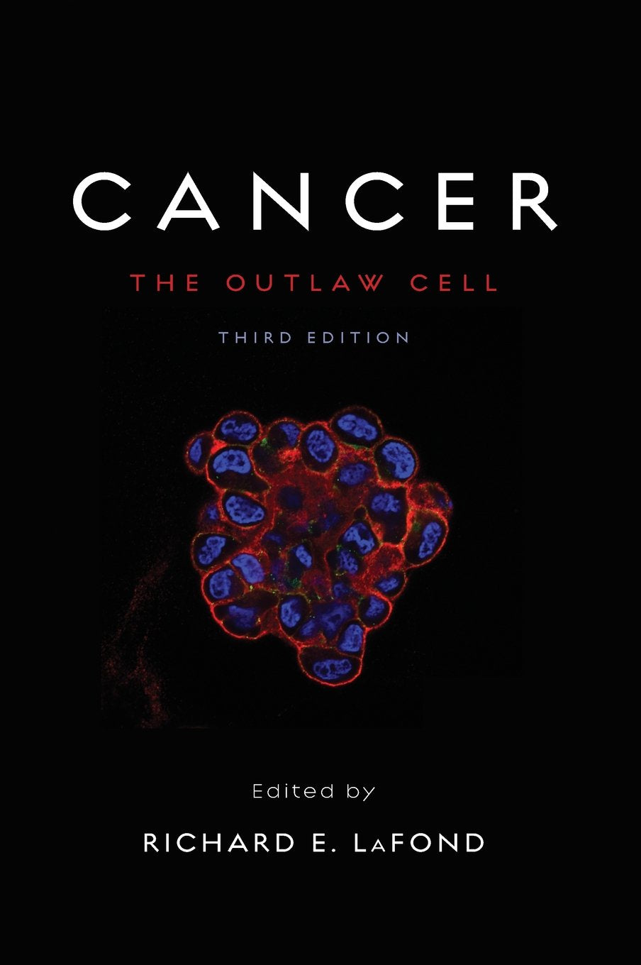 Cancer: The Outlaw Cell,Used