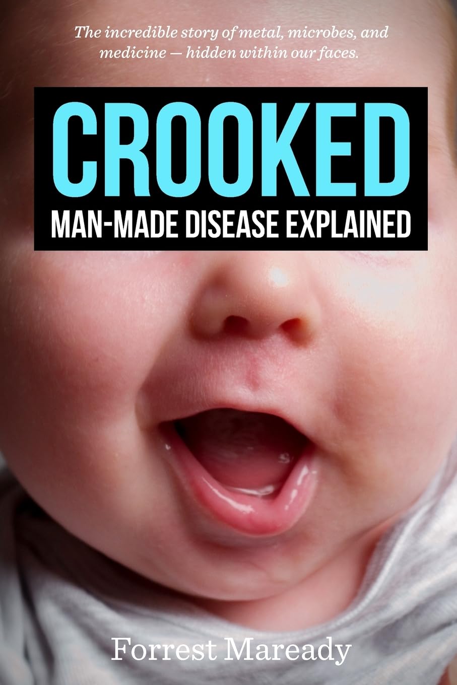 Crooked: ManMade Disease Explained: The incredible story of metal, microbes, and medicine  hidden within our faces.,New