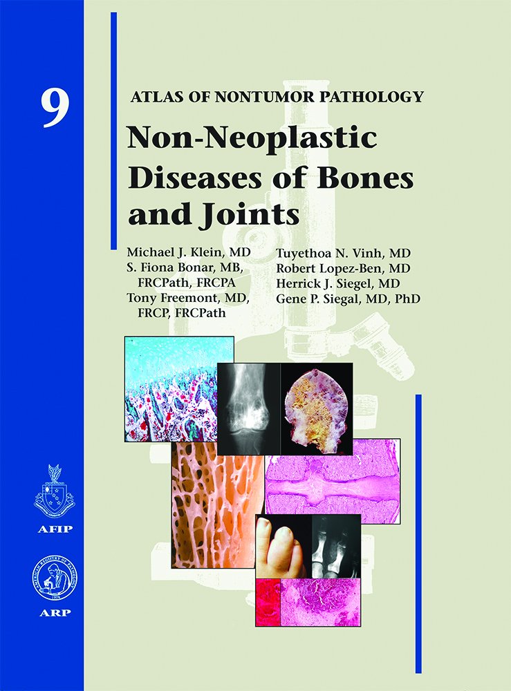 NonNeoplastic Diseases of Bones and Joints,Used