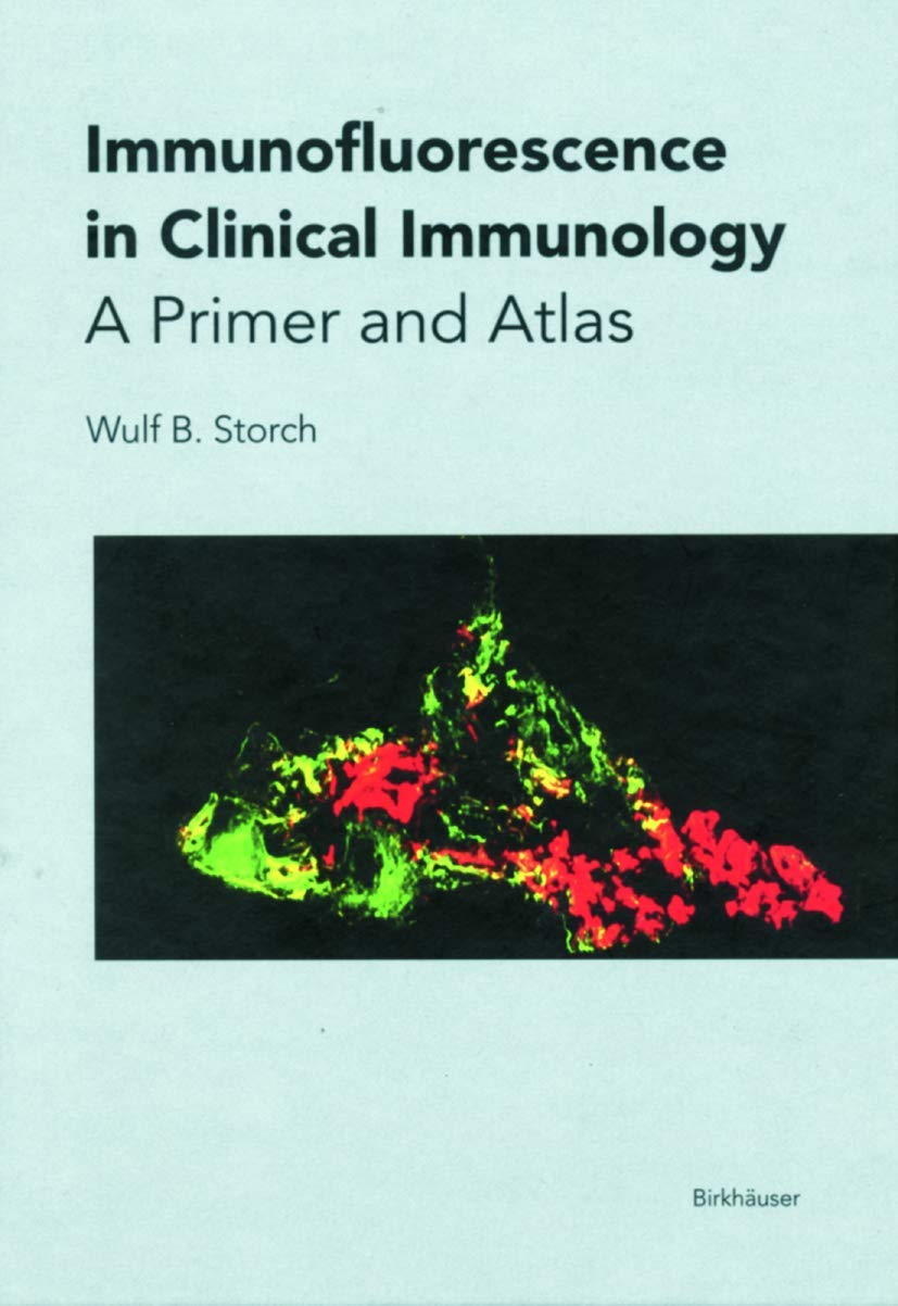 Immunofluorescence in Clinical Immunology: A Primer and Atlas,Used
