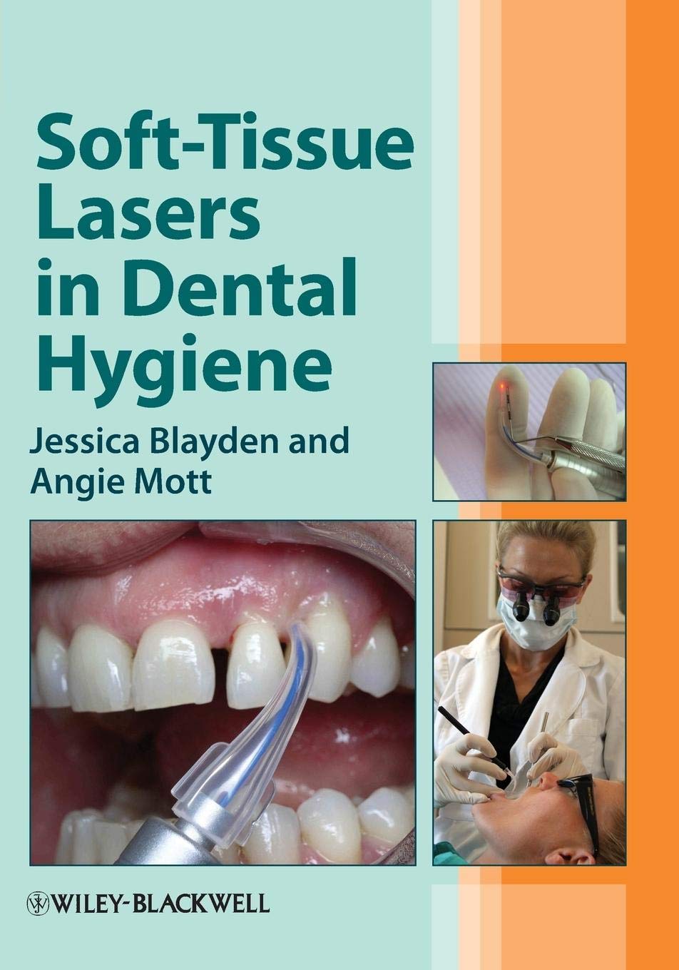 SoftTissue Lasers in Dental Hygiene,Used
