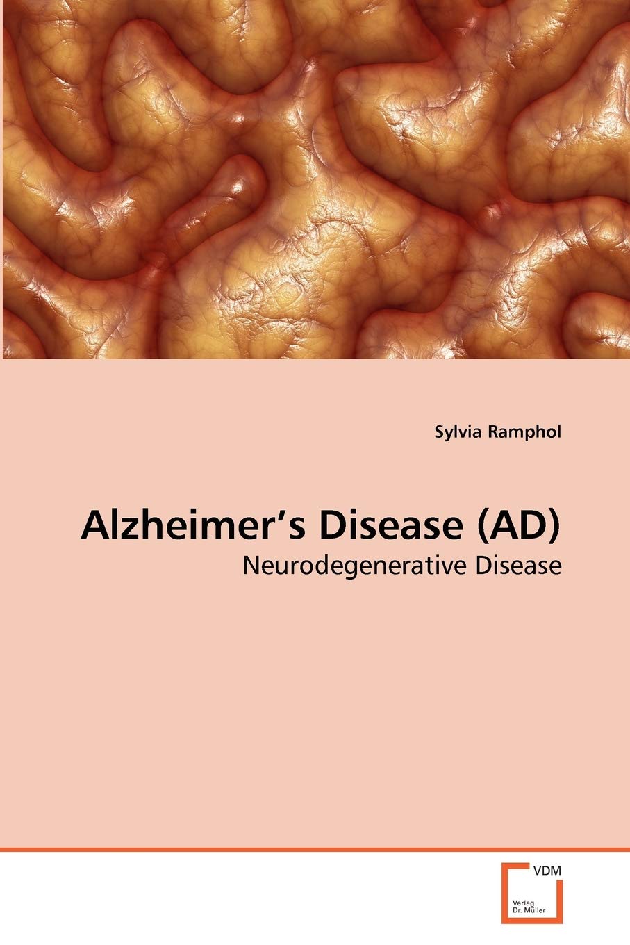 Alzheimer's Disease (AD): Neurodegenerative Disease,Used