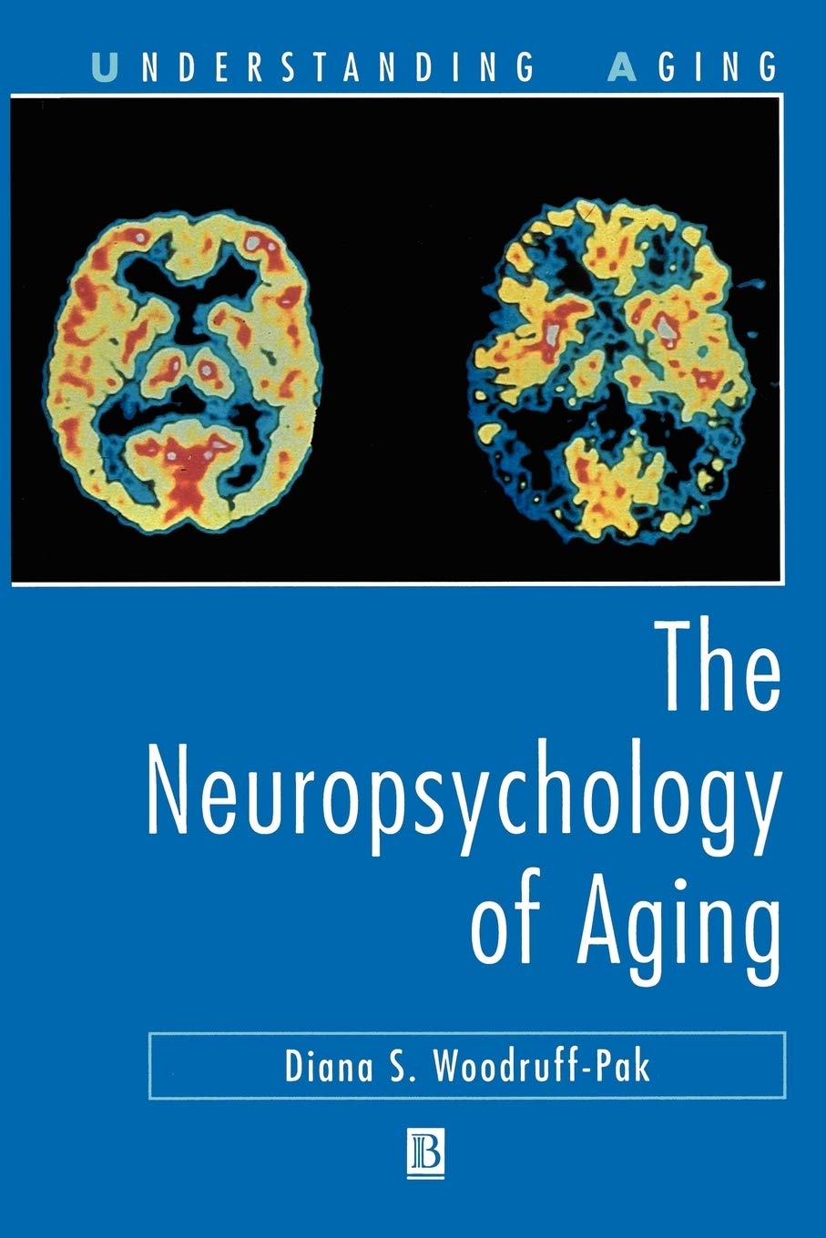 The Neuropsychology of Aging,Used