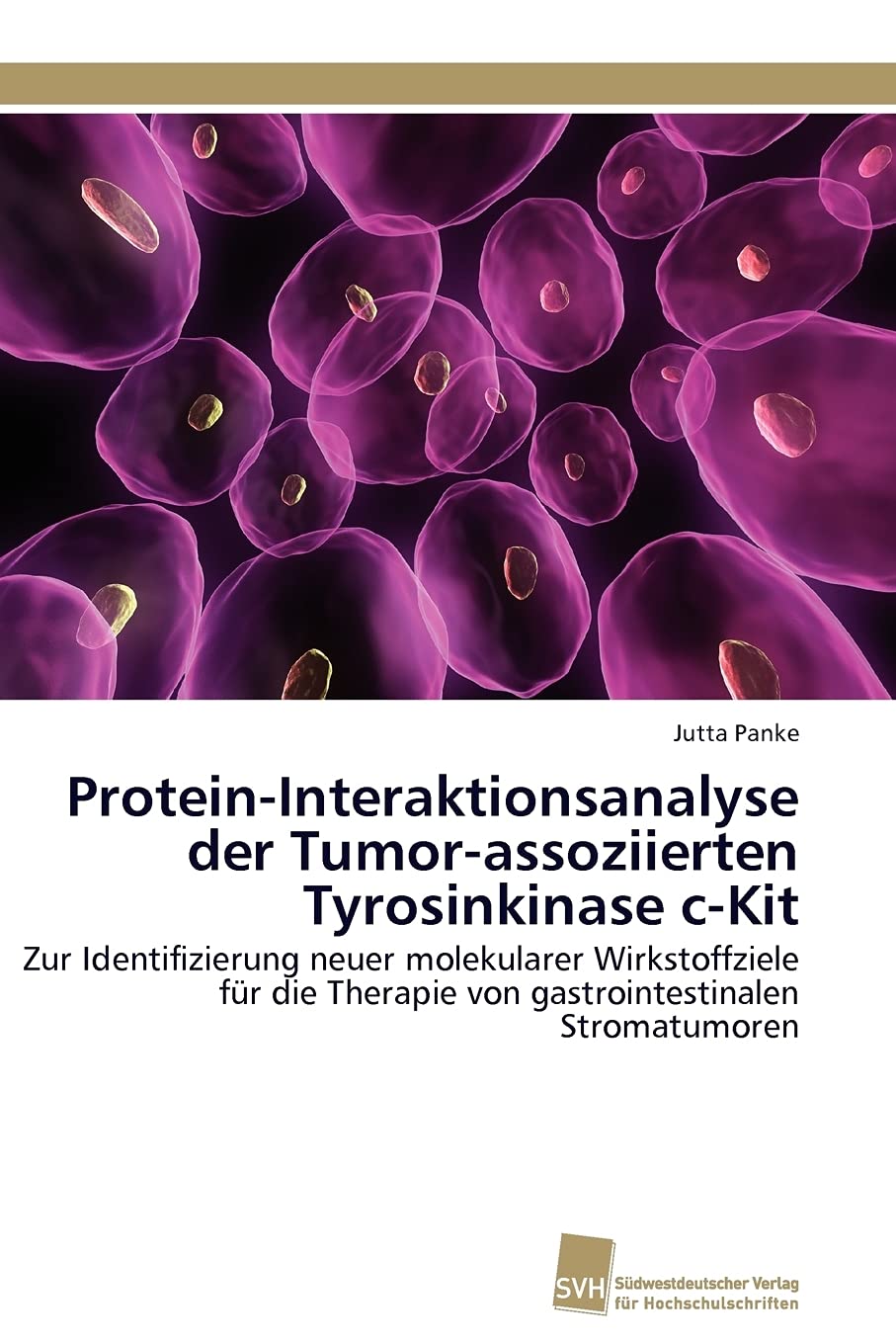 ProteinInteraktionsanalyse der Tumorassoziierten Tyrosinkinase cKit: Zur Identifizierung neuer molekularer Wirkstoffziele fr ,Used