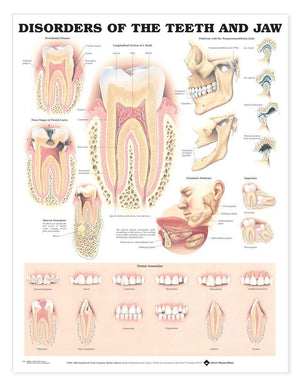 Disorders of the Teeth and Jaw Anatomical Chart-New Condition