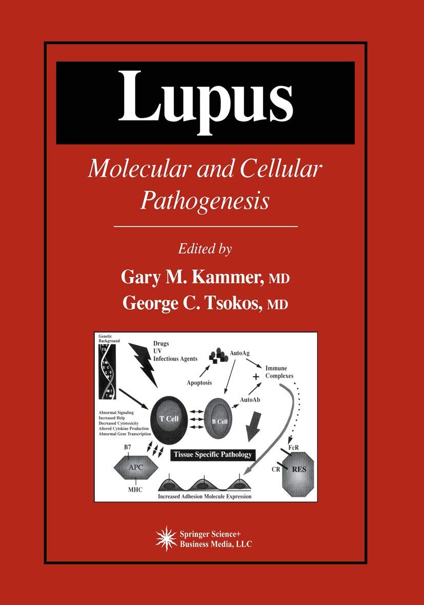 Lupus: Molecular and Cellular Pathogenesis (Contemporary Immunology),Used