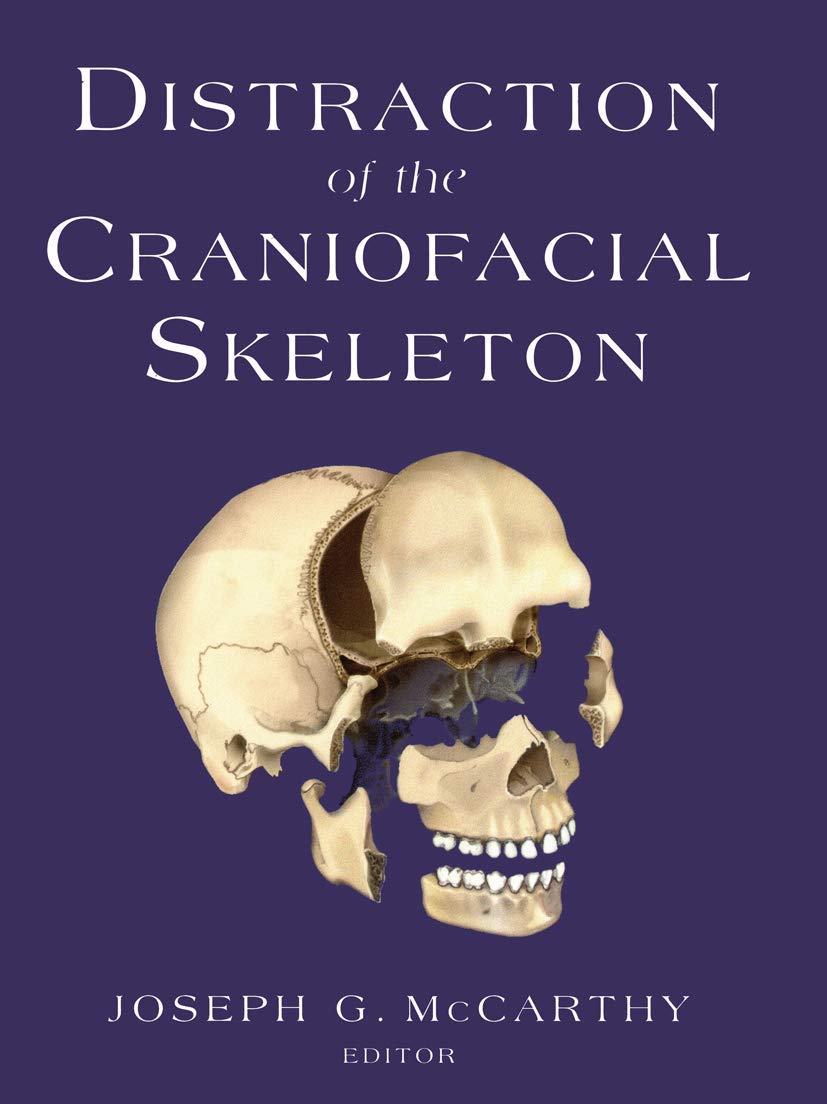 Distraction Of The Craniofacial Skeleton,Used