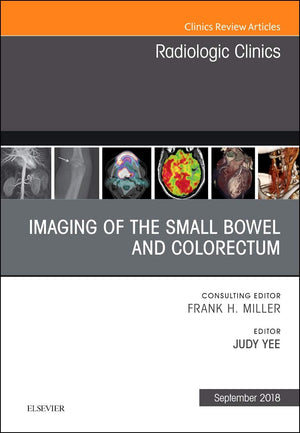 Imaging of the Small Bowel and Colorectum, An Issue of Radiologic Clinics of North America (Volume 565) (The Clinics: Radiology,Used