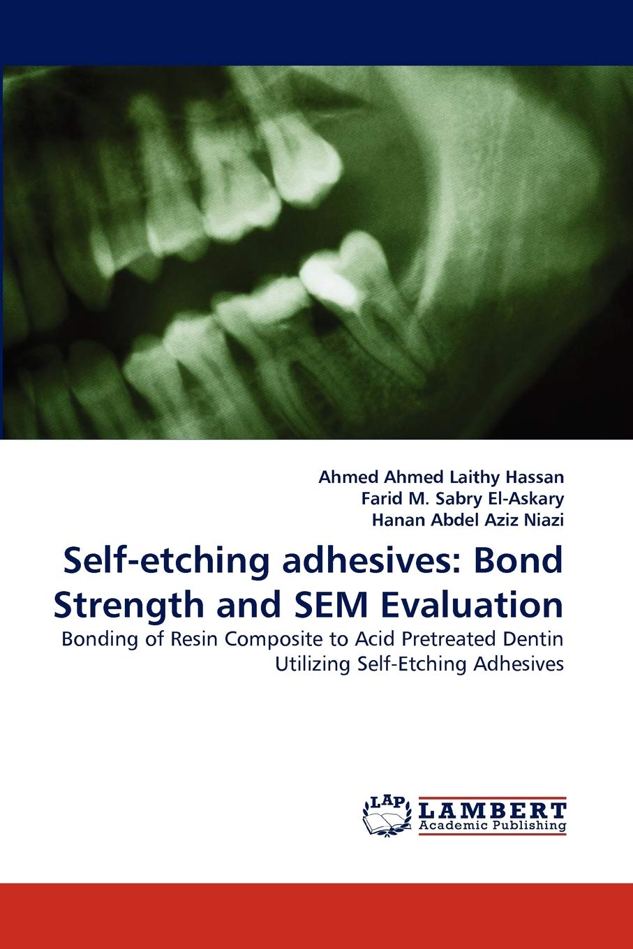 Selfetching adhesives: Bond Strength and SEM Evaluation: Bonding of Resin Composite to Acid Pretreated Dentin Utilizing SelfEt,Used