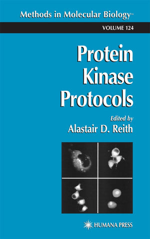 Protein Kinase Protocols (Methods in Molecular Biology, 124),Used
