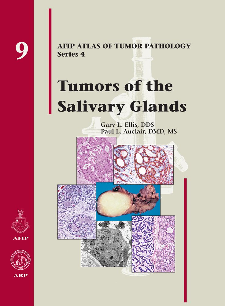 Tumors of the Salivary Glands (AFIP Atlas of Tumor Pathology: Series 4),New