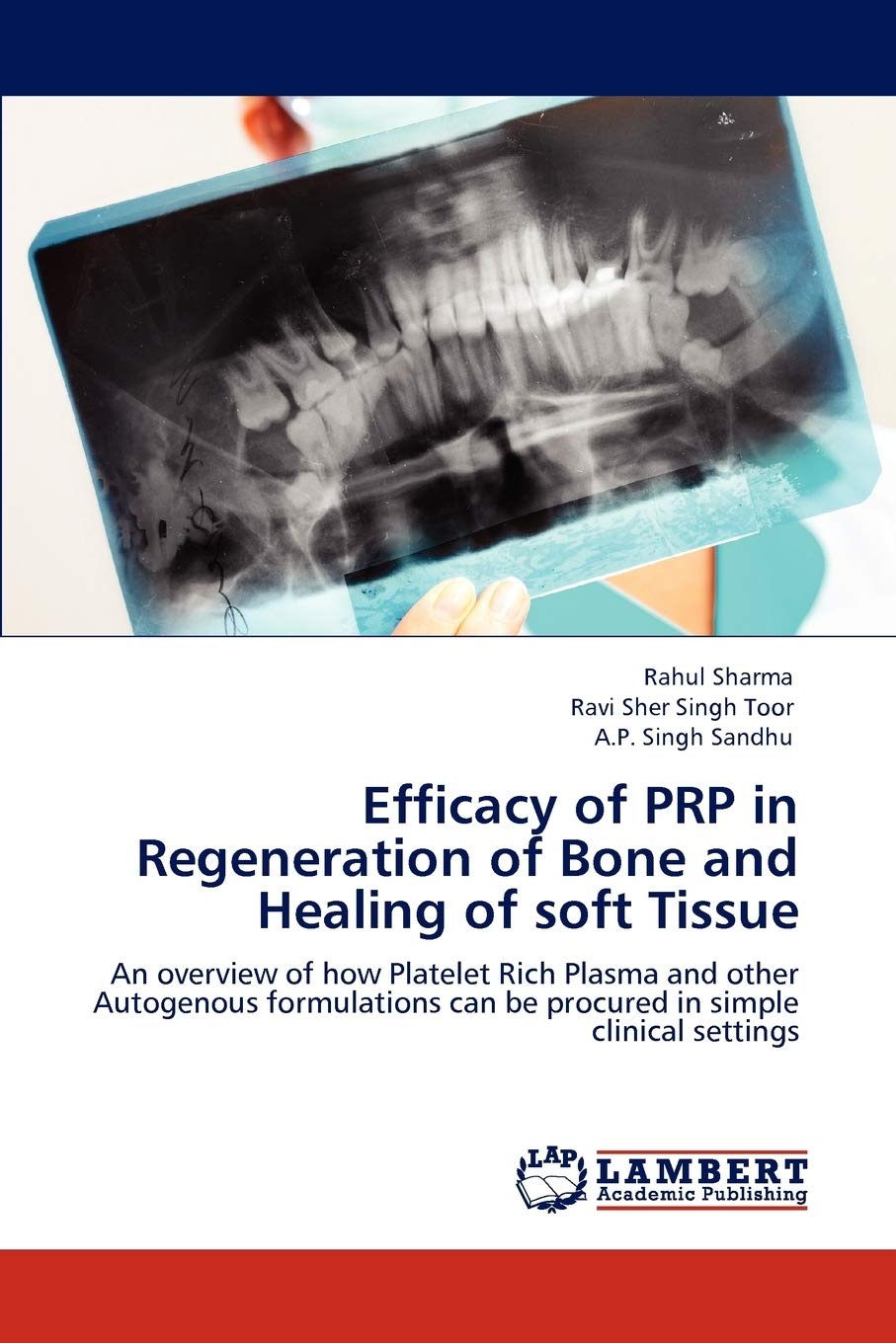 Efficacy of PRP in Regeneration of Bone and Healing of soft Tissue: An overview of how Platelet Rich Plasma and other Autogenous,Used