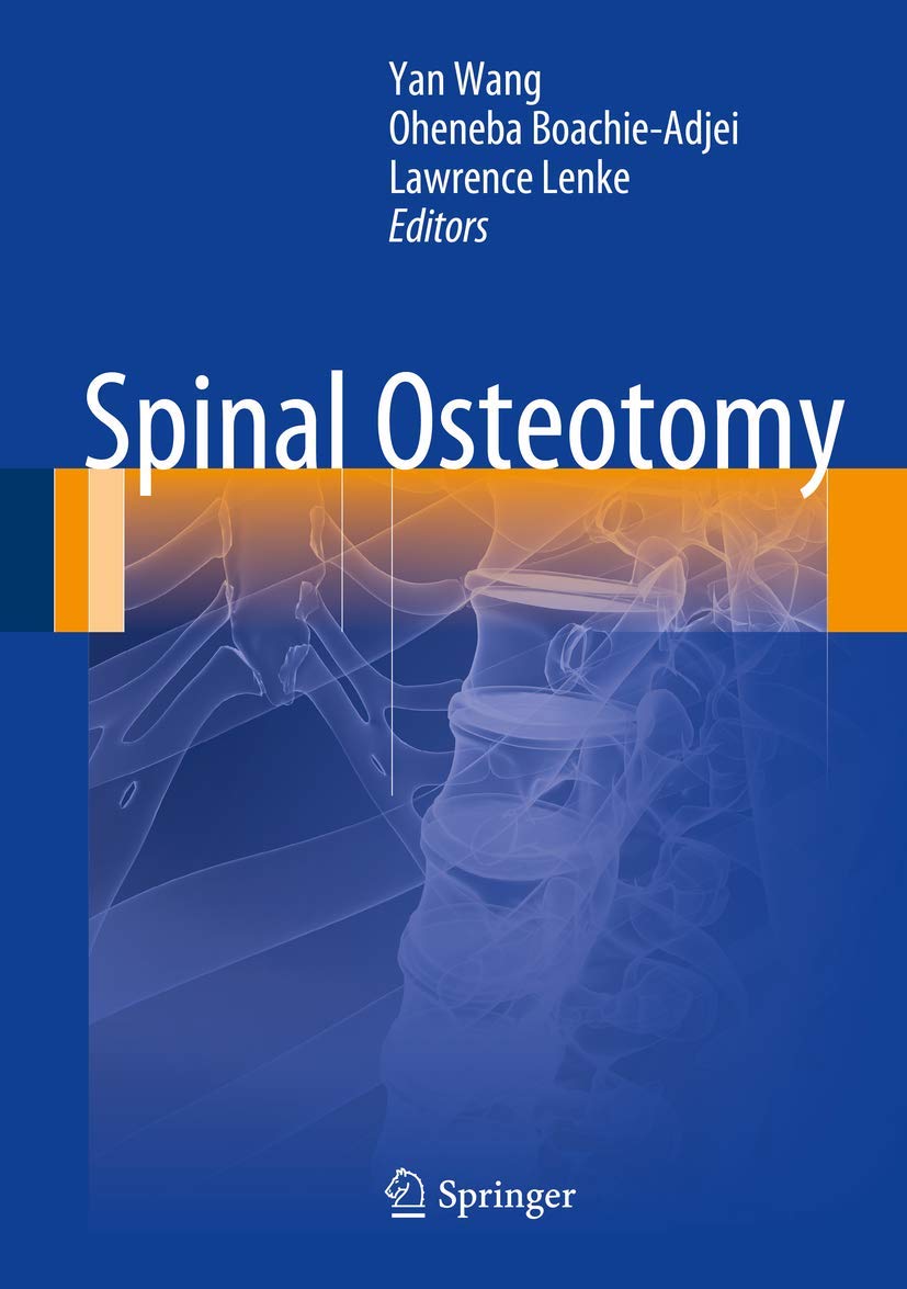 Spinal Osteotomy,Used