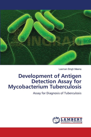 Development of Antigen Detection Assay for Mycobacterium Tuberculosis: Assay for Diagnosis of Tuberculosis,Used