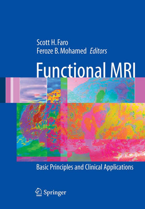 Functional MRI: Basic Principles and Clinical Applications,Used