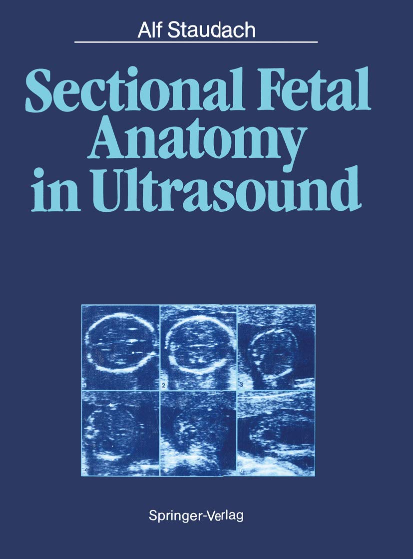 Sectional Fetal Anatomy In Ultrasound,Used