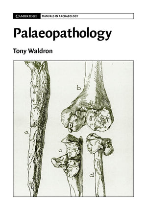 Palaeopathology (Cambridge Manuals in Archaeology),Used