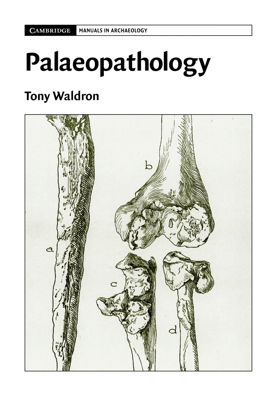 Palaeopathology (Cambridge Manuals in Archaeology),Used