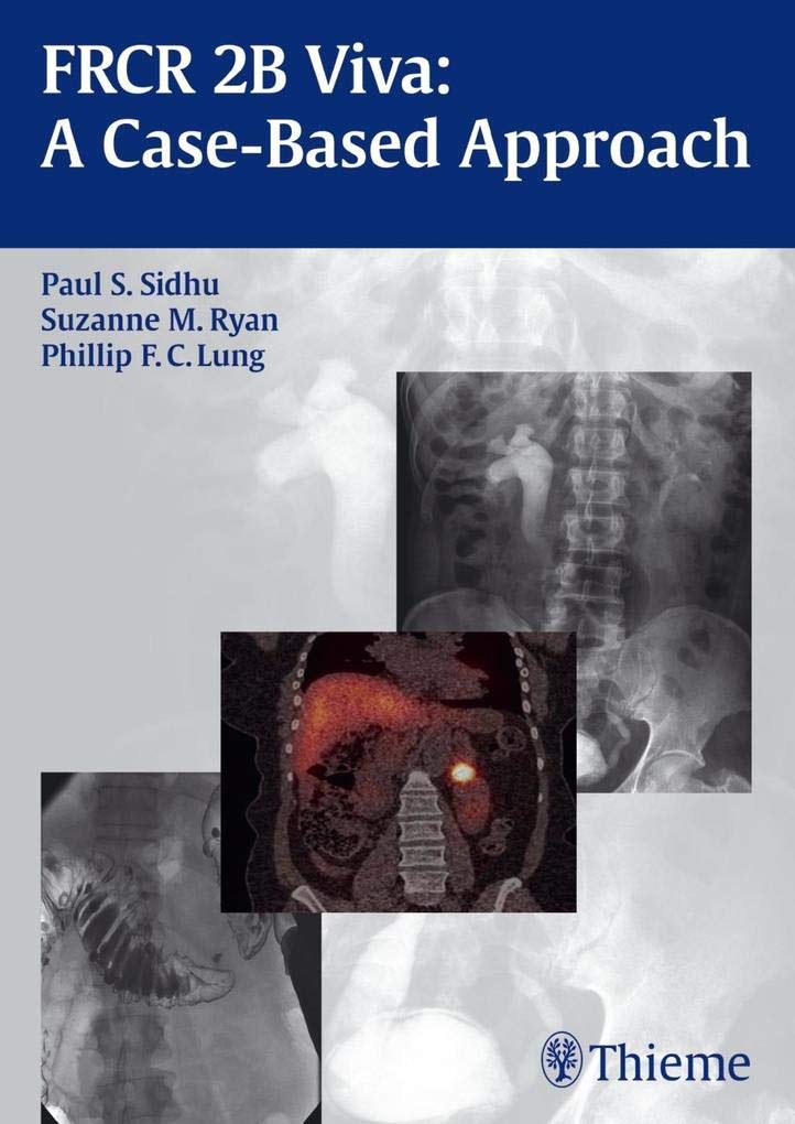 Frcr 2B Viva: A Casebased Approach,Used