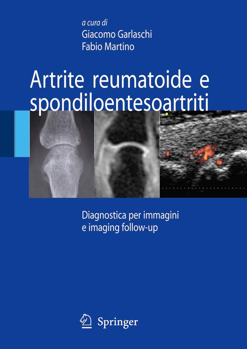 Artrite reumatoide e spondiloentesoartriti: Diagnostica per immagini ed imaging followup (Italian Edition),Used