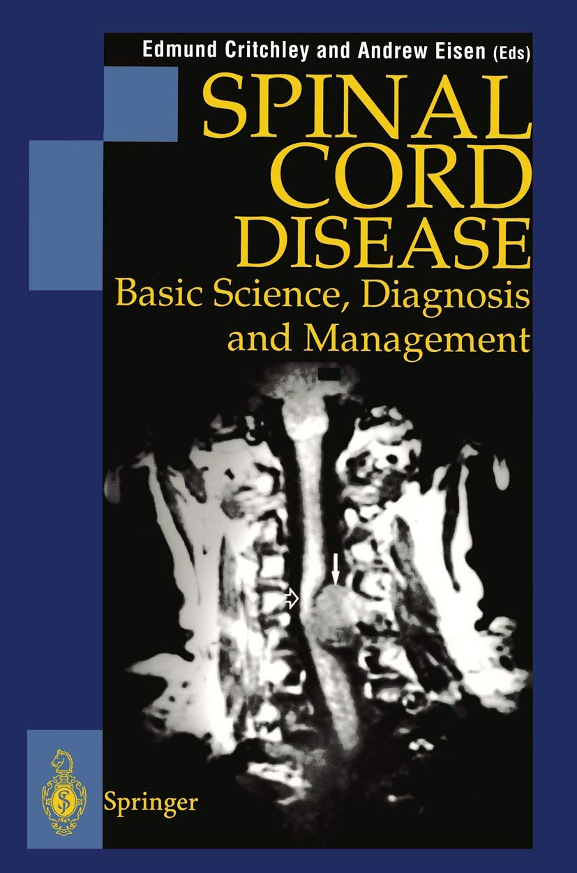 Spinal Cord Disease: Basic Science, Diagnosis and Management,Used
