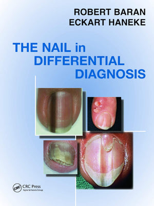 Nail In Differential Diagnosis,New