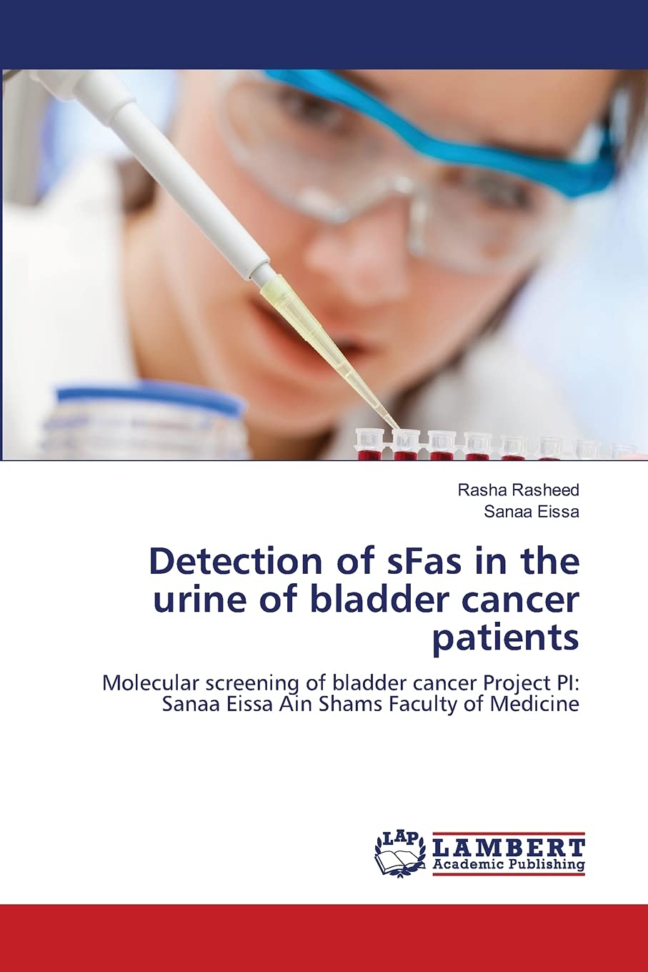 Detection of sFas in the urine of bladder cancer patients: Molecular screening of bladder cancer Project PI: Sanaa Eissa Ain Sha,Used