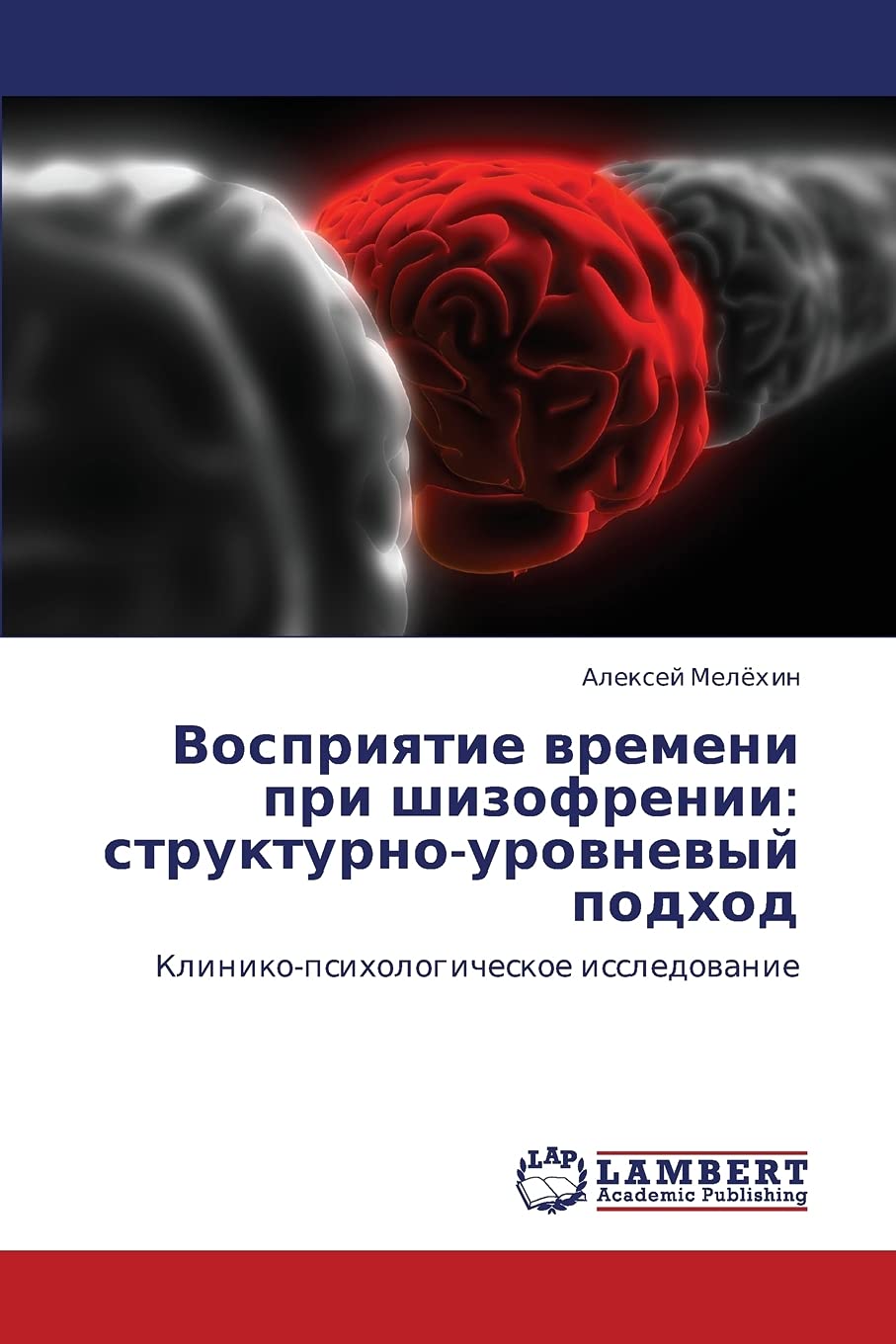 Vospriyatie vremeni pri shizofrenii: strukturnourovnevyy podkhod: Klinikopsikhologicheskoe issledovanie (Russian Edition),Used