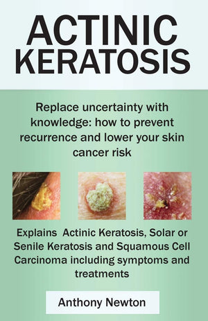 Actinic Keratosis. Replace The Fear And Uncertainty With Knowledge: How To Prevent Recurrence And Lower Your Skin Cancer Risk.