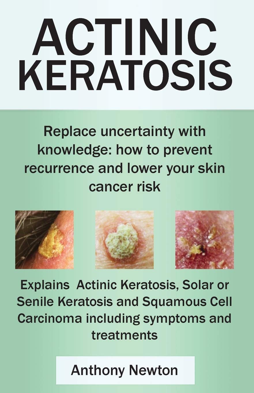 Actinic Keratosis. Replace The Fear And Uncertainty With Knowledge: How To Prevent Recurrence And Lower Your Skin Cancer Risk.