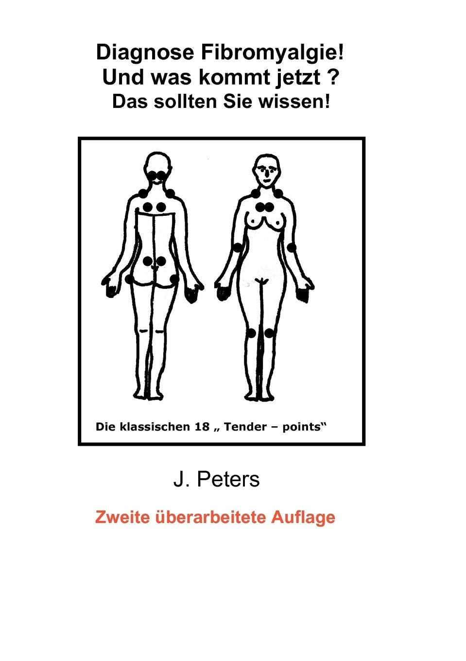Diagnose Fibromyalgie! Und was kommt jetzt?: Das sollten sie Wissen! (German Edition),Used