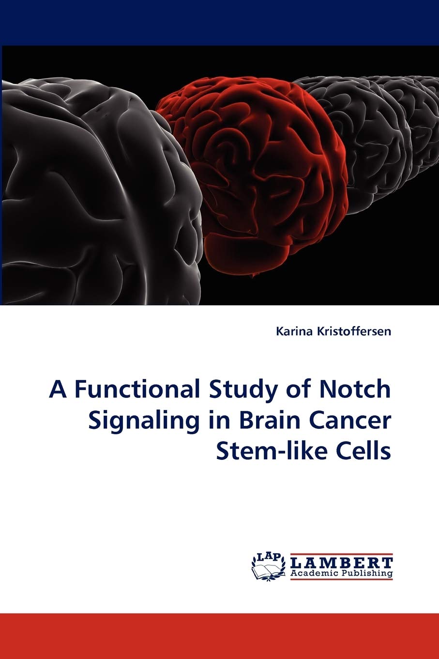 A Functional Study of Notch Signaling in Brain Cancer Stemlike Cells,Used