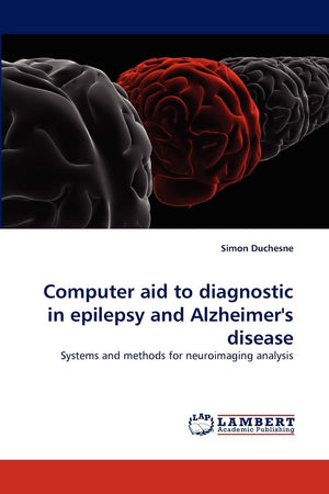 Computer aid to diagnostic in ?epilepsy and ?Alzheimer's disease: Systems and methods for neuroimaging analysis,Used