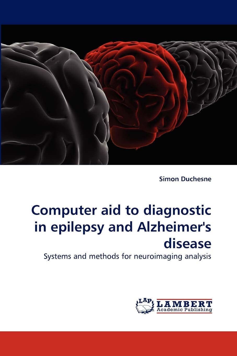Computer aid to diagnostic in ?epilepsy and ?Alzheimer's disease: Systems and methods for neuroimaging analysis,Used