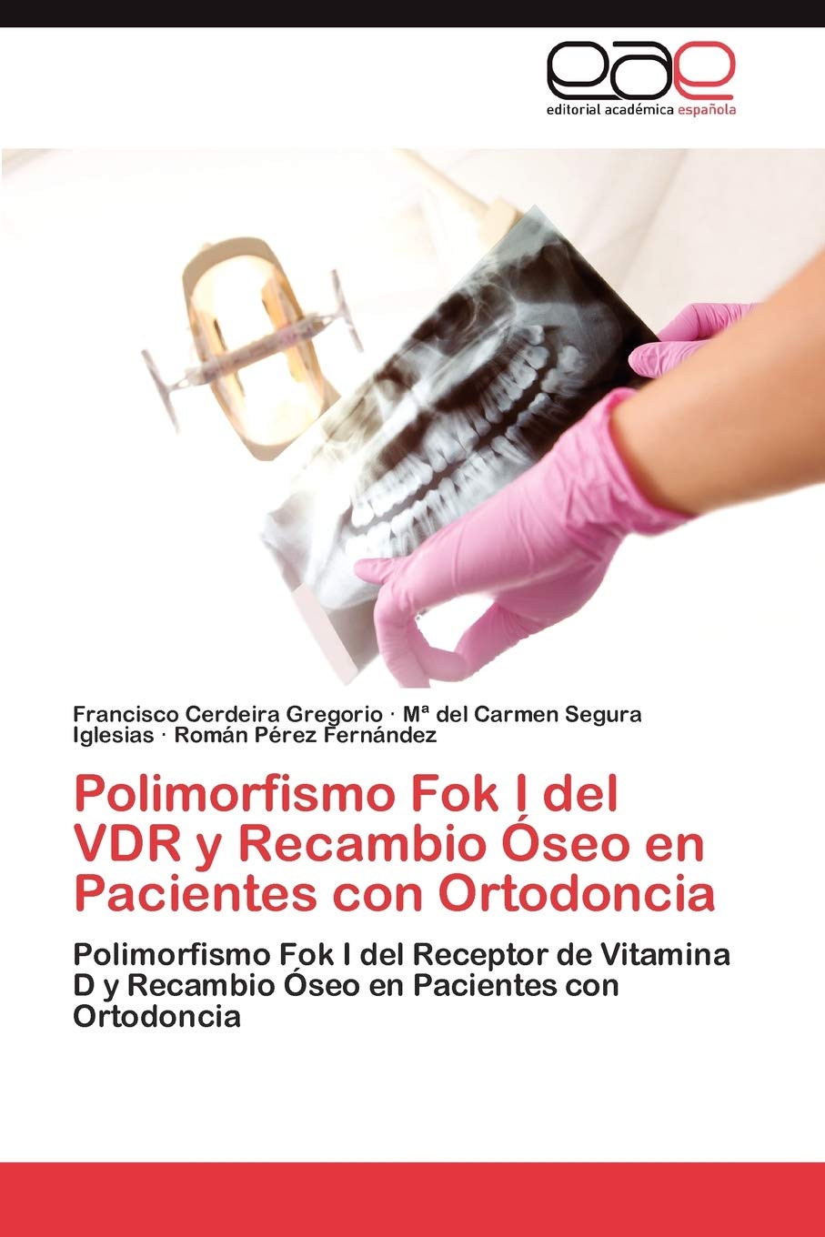 Polimorfismo Fok I del VDR y Recambio seo en Pacientes con Ortodoncia: Polimorfismo Fok I del Receptor de Vitamina D y Recambi,Used