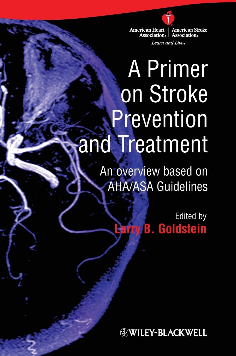 A Primer on Stroke Prevention and Treatment: An Overview Based on Aha/Asa Guidelines,Used