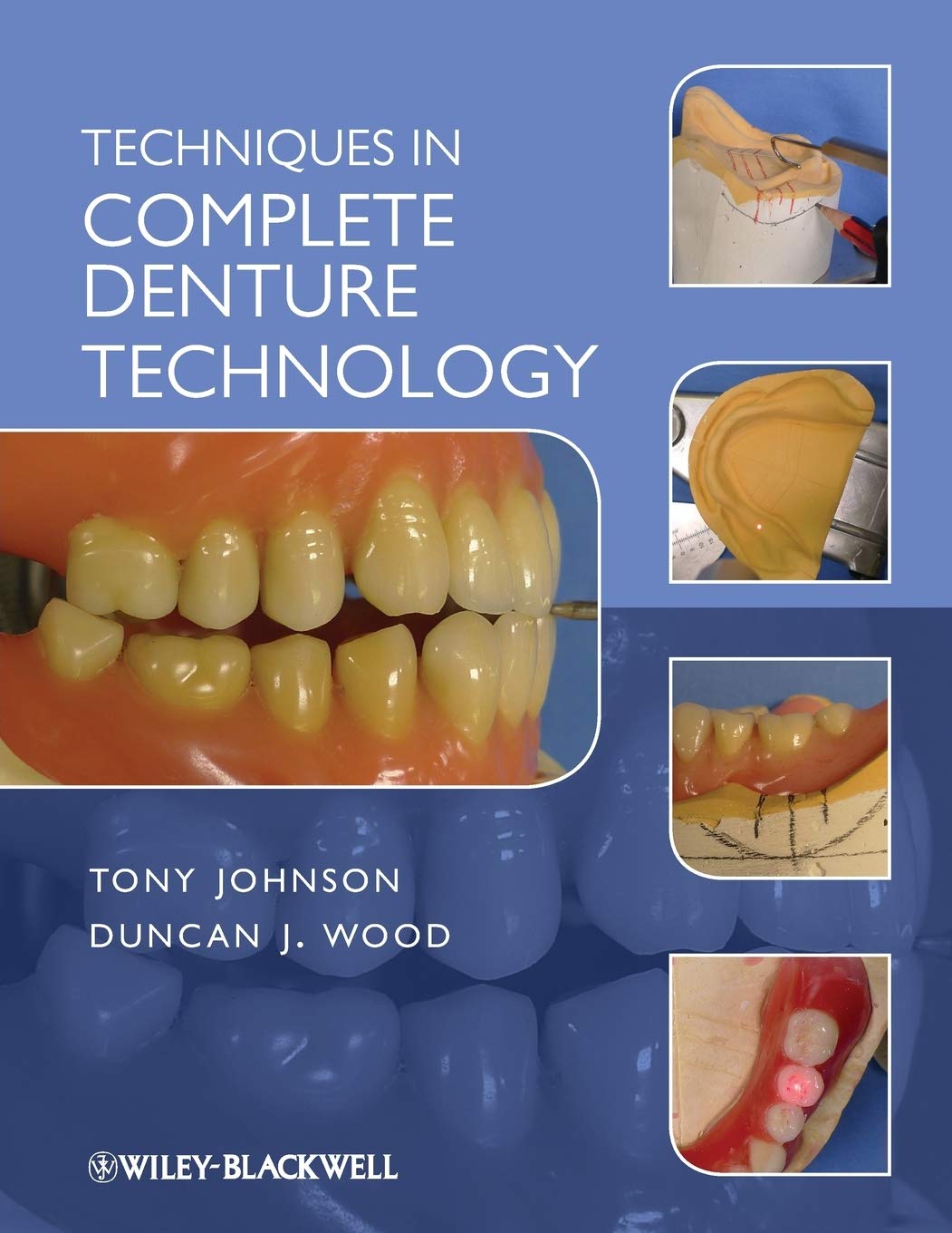 Techniques in Complete Denture Technology,Used