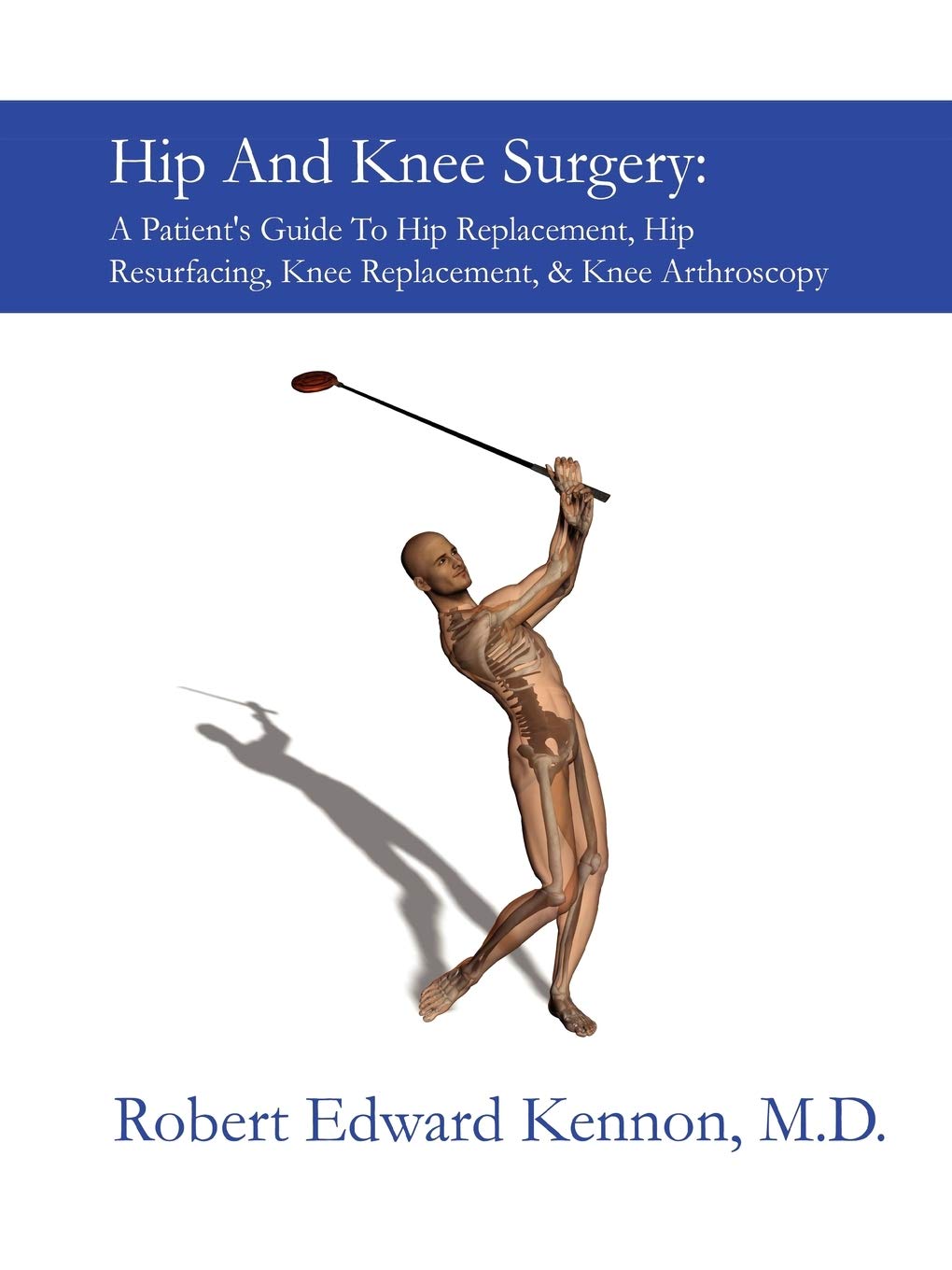 Hip And Knee Surgery: A Patient's Guide To Hip Replacement, Hip Resurfacing, Knee Replacement, And Knee Arthroscopy,Used