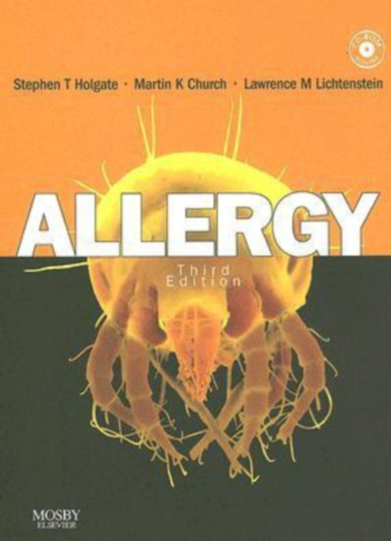 Allergy: Expert Consult Online and Print,Used